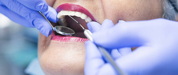 Best Teeth Whitening  in Manly, IA